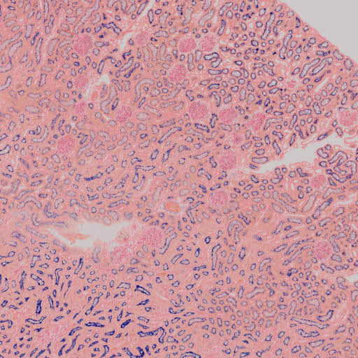 fhmloisrv1501.unimaas.nl - /anatomie/Web images/uropoetic system/kidney